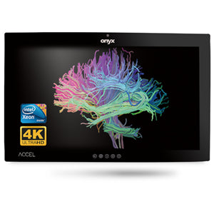 Onyx ACCEL-A3201 i7 32" 4K OR Station PCAP Touch