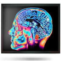 Onyx MEDDP-415HNN 15" Medical Display