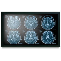 Onyx MEDDP-622HNN 21.5" Medical Display
