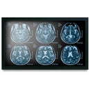 Onyx MEDDP-622HPN 21.5" Medical Touch Display